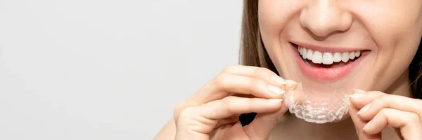Discover the Typical Invisalign Treatment Timelines in Fort Worth, TX for a Perfect Smile